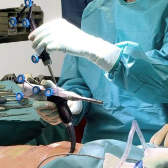 Einsatz eines robotergestützten Instruments bei der Implantation einer Knieendoprothese im OP.