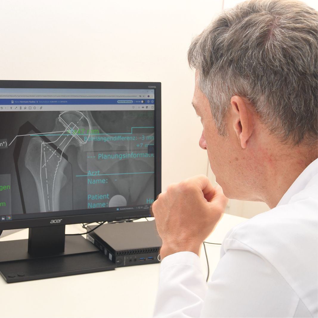 Dr. med. Andreas Bell sitzt am Schreibtisch und schaut sich Digitale Ausrichtungslinien und Messwerte zur Planung einer Hüftprothese an.