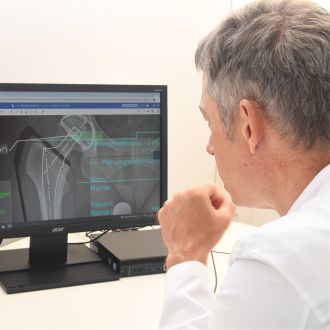 Dr. med. Andreas Bell sitzt am Schreibtisch und schaut sich Digitale Ausrichtungslinien und Messwerte zur Planung einer Hüftprothese an.