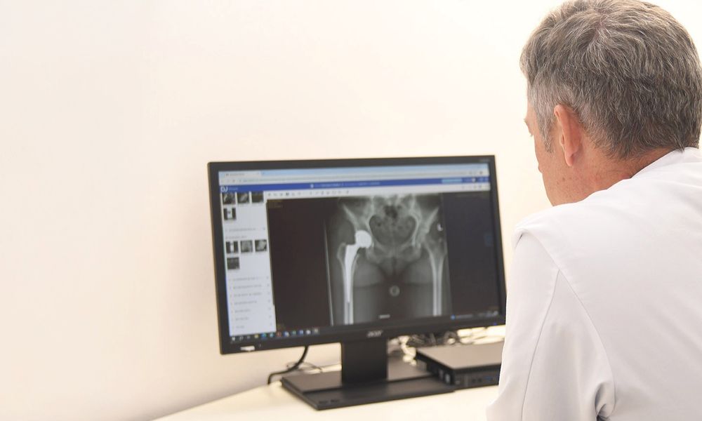 Arzt betrachtet Röntgenaufnahme eines Hüftgelenks am Monitor.