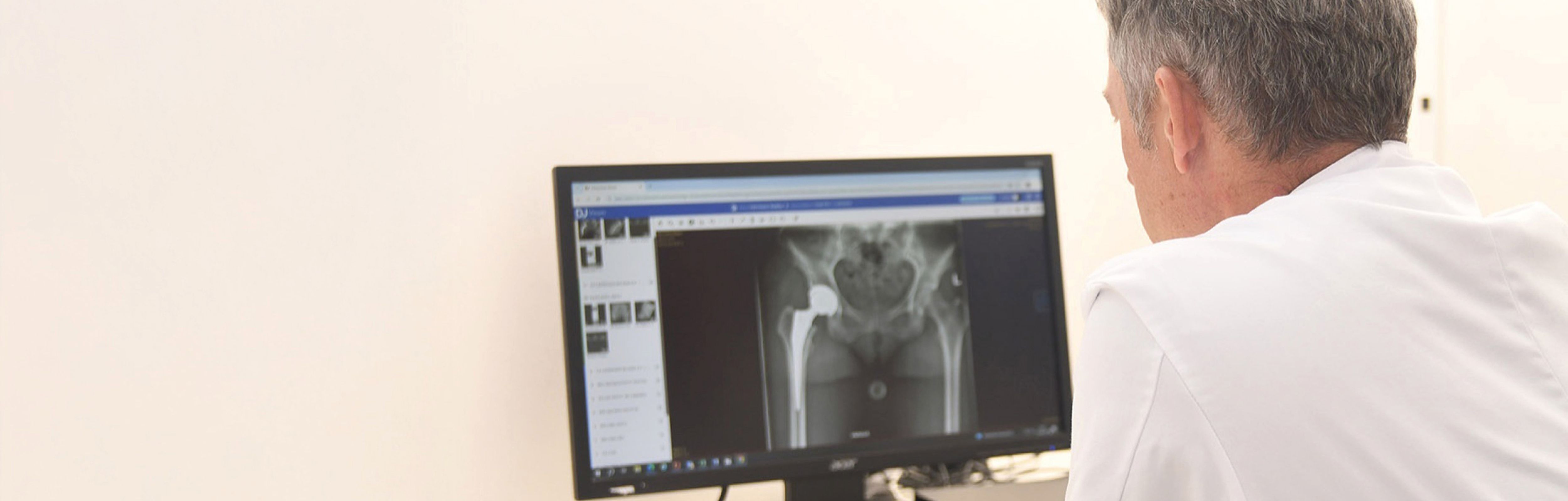 Arzt betrachtet Röntgenaufnahme eines Hüftgelenks am Monitor.