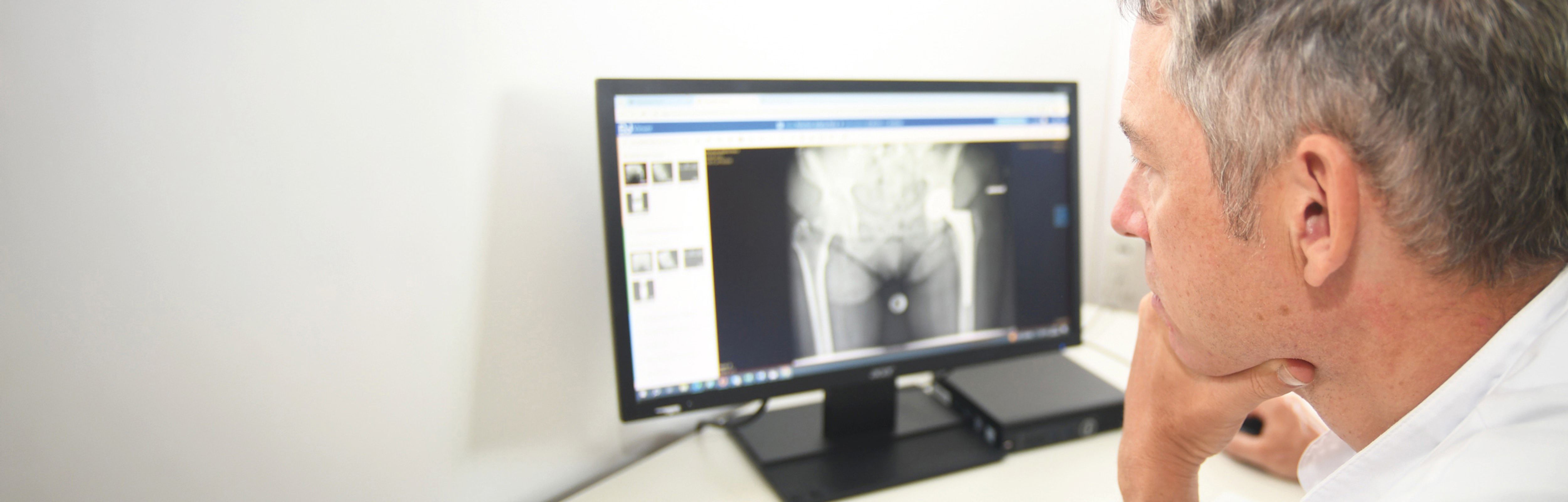 Arzt betrachtet Röntgenaufnahme eines Hüftgelenks am Monitor.