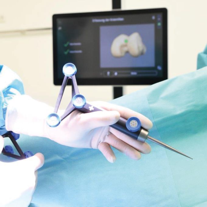 Chirurg hält ein robotergestütztes Instrument zur Vorbereitung einer Knieoperation.