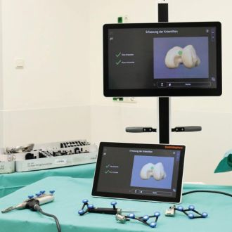 Medizinisches Navigationssystem mit Monitoren zur Planung einer Knieendoprothese.